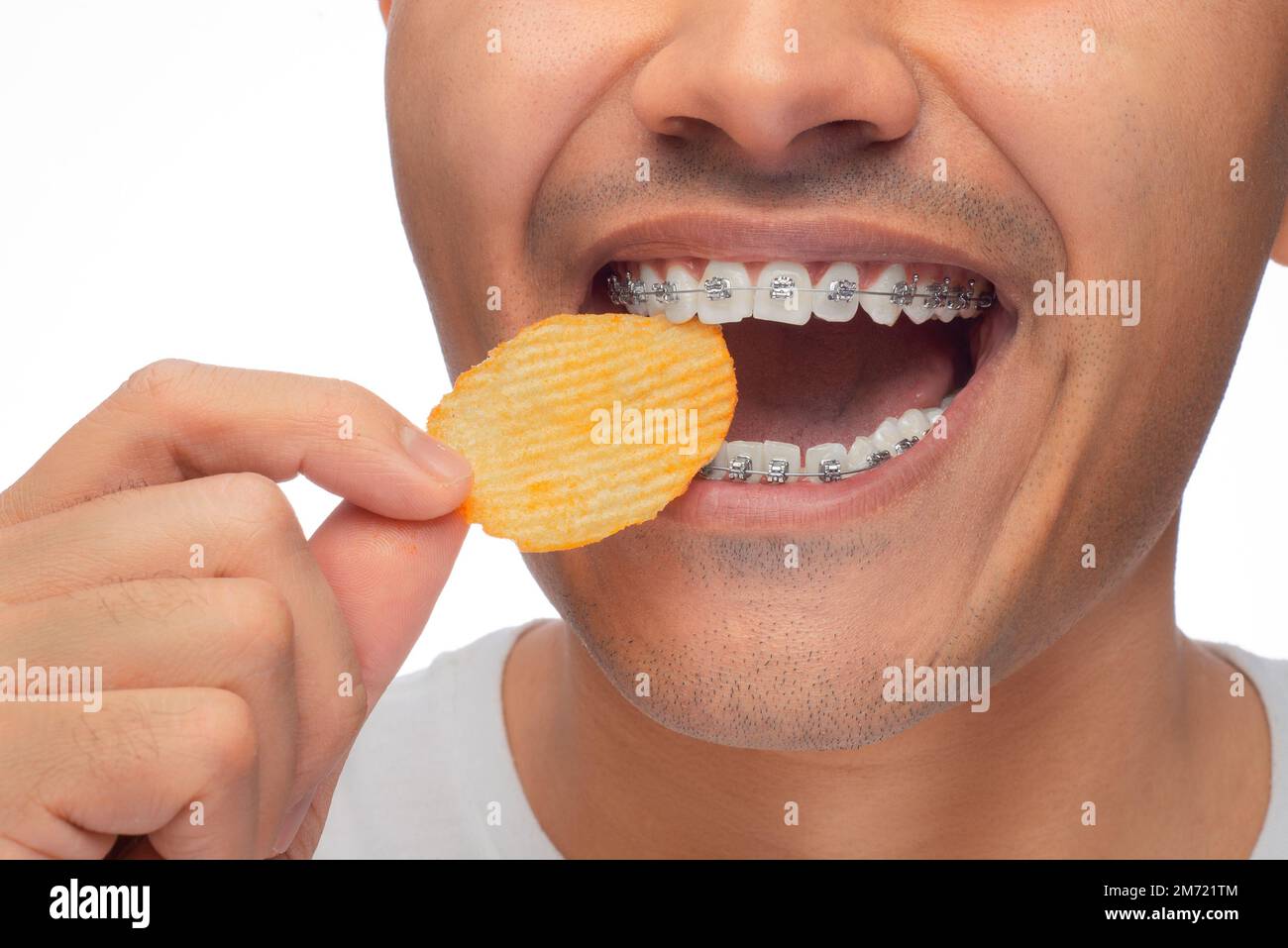 Latin man with brown skin, bites a potato chip with his braces, misuse