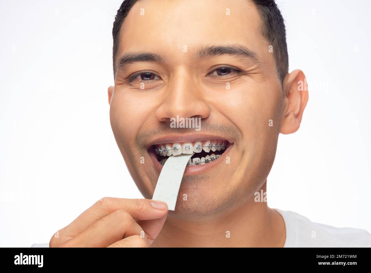 Brownskinned Latino man, bites a chewing gum with his braces, misuse