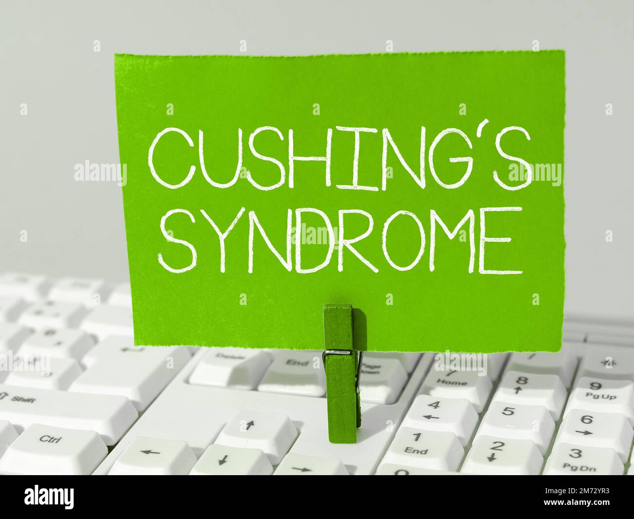 Handwriting text Cushing's Syndrome. Conceptual photo a disorder caused by corticosteroid hormone overproduction Stock Photo