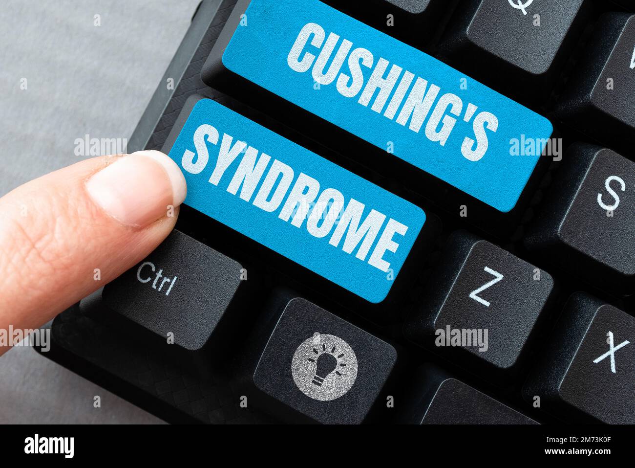 Handwriting text Cushing's Syndrome. Business approach a disorder caused by corticosteroid hormone overproduction Stock Photo