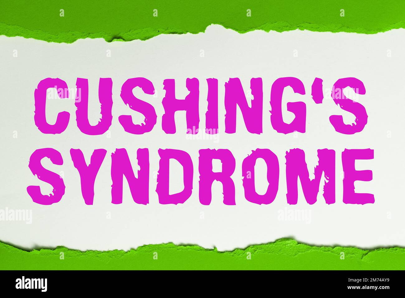 Text sign showing Cushing's Syndrome. Concept meaning a disorder caused