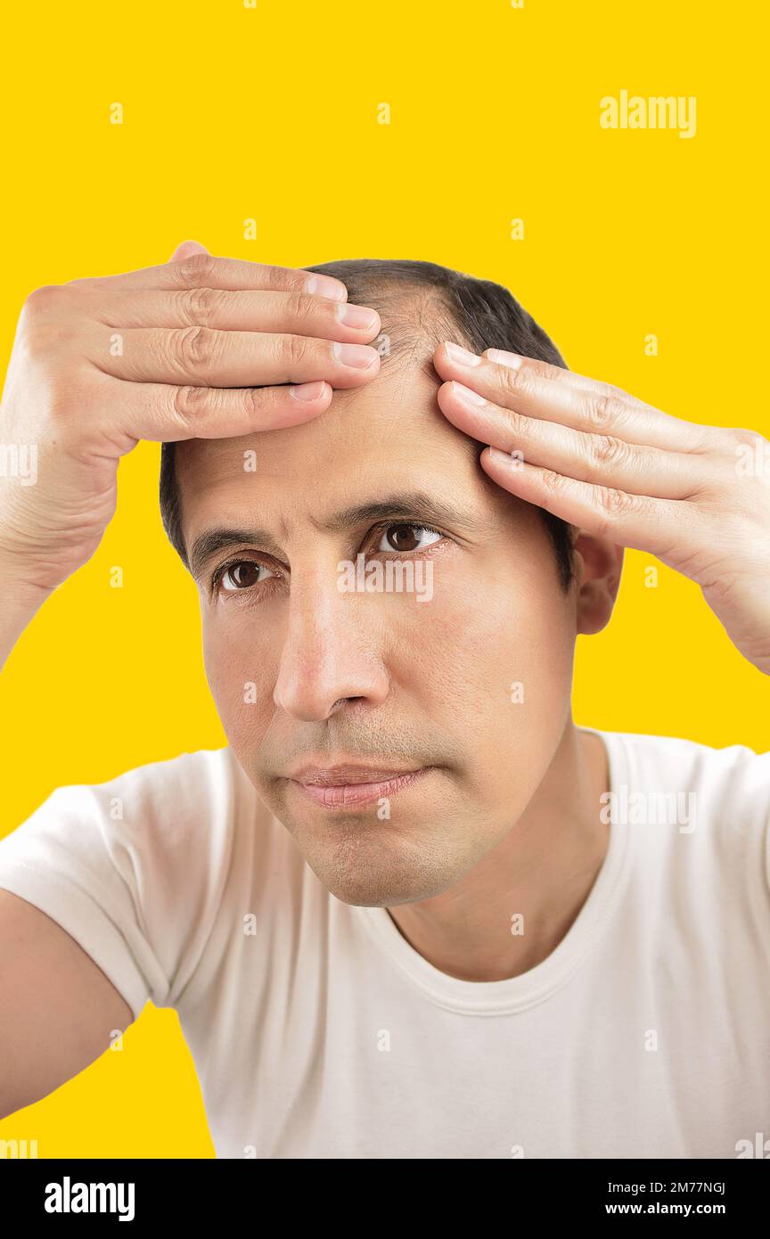 Shot of a  man controls hair loss with yellow background Stock Photo