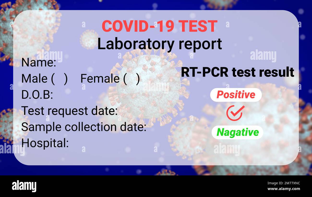 covid laboratory test report with blank personal details and final result. Stock Photo