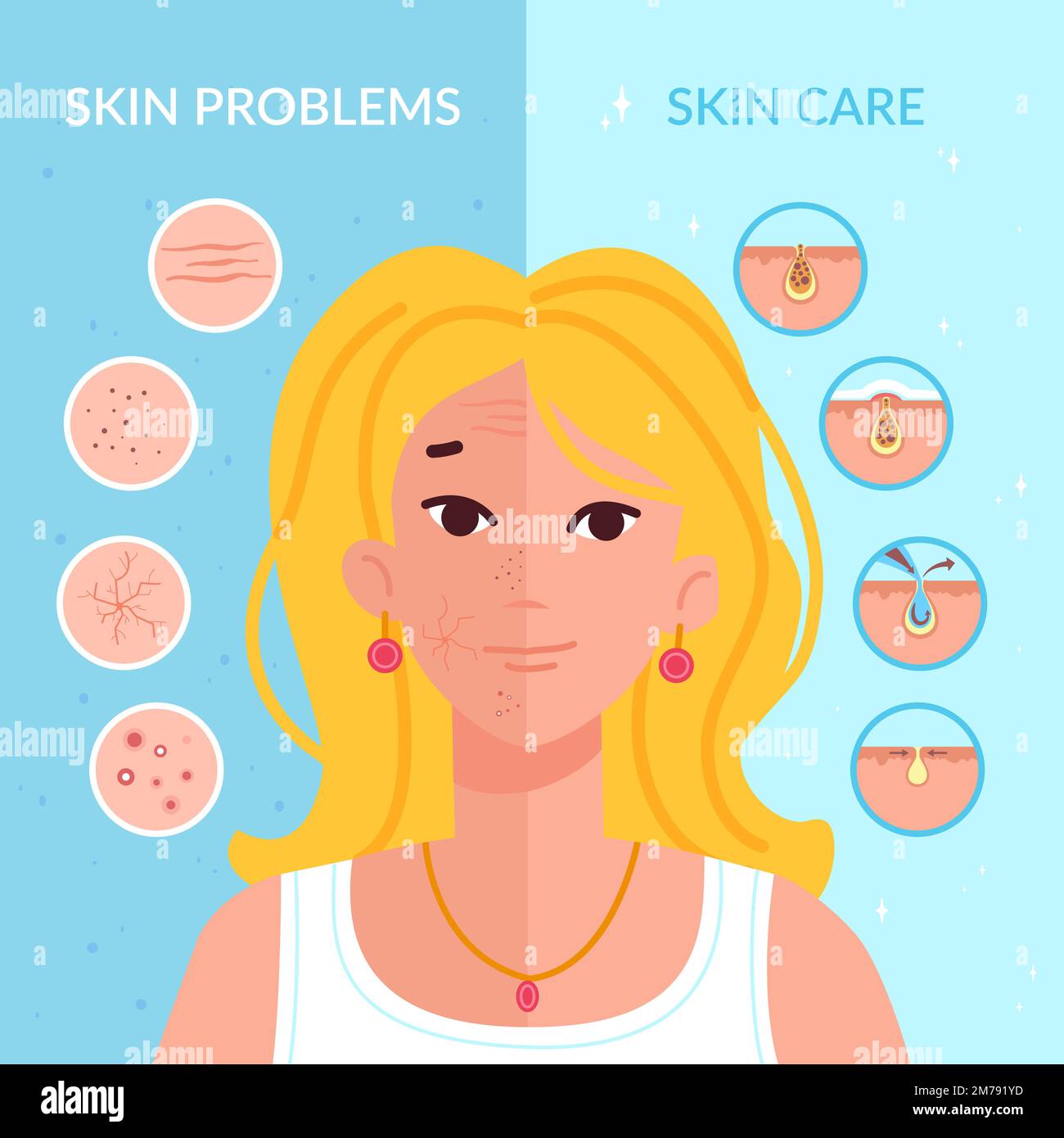 Skin problems solution. Home skincare treatment procedures, teenager