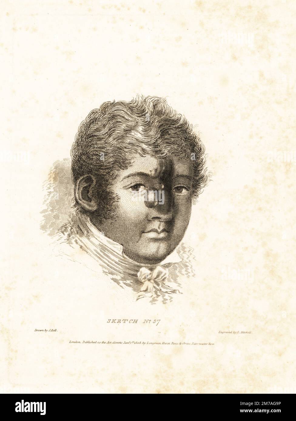 Fatal cancerous tumor on the face of a gentleman from Birmingham. Grew from a small speck to a large pulsating, bleeding tumor over nine years. According to doctor George Freer, the patient declined treatment and died of hemorrhagy. Copperplate engraving by Edward Mitchell after an illustration by John Bell from his own Principles of Surgery, as they Relate to Wounds, Ulcers and Fistulas, Longman,  Hurst, Rees, Orme and Brown, London, 1815. Stock Photo
