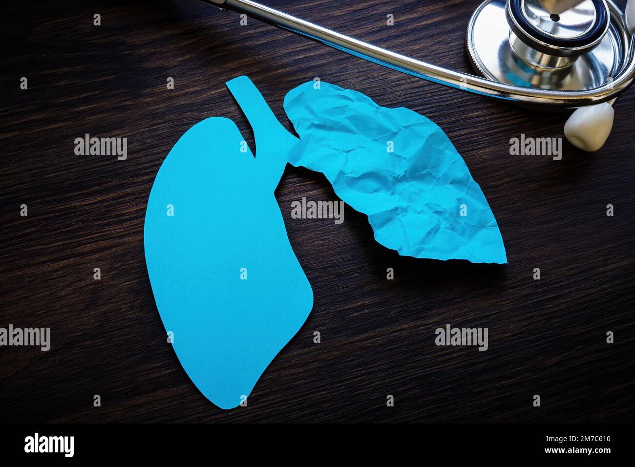 Stethoscope and one crumpled paper lung as a ground glass opacity after covid. Stock Photo