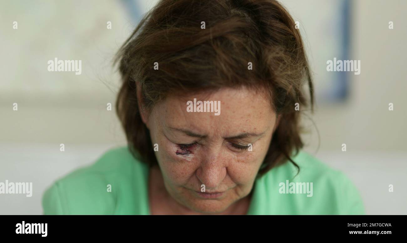 Older woman with face and bruise in face looking down, sad emotion Stock Photo