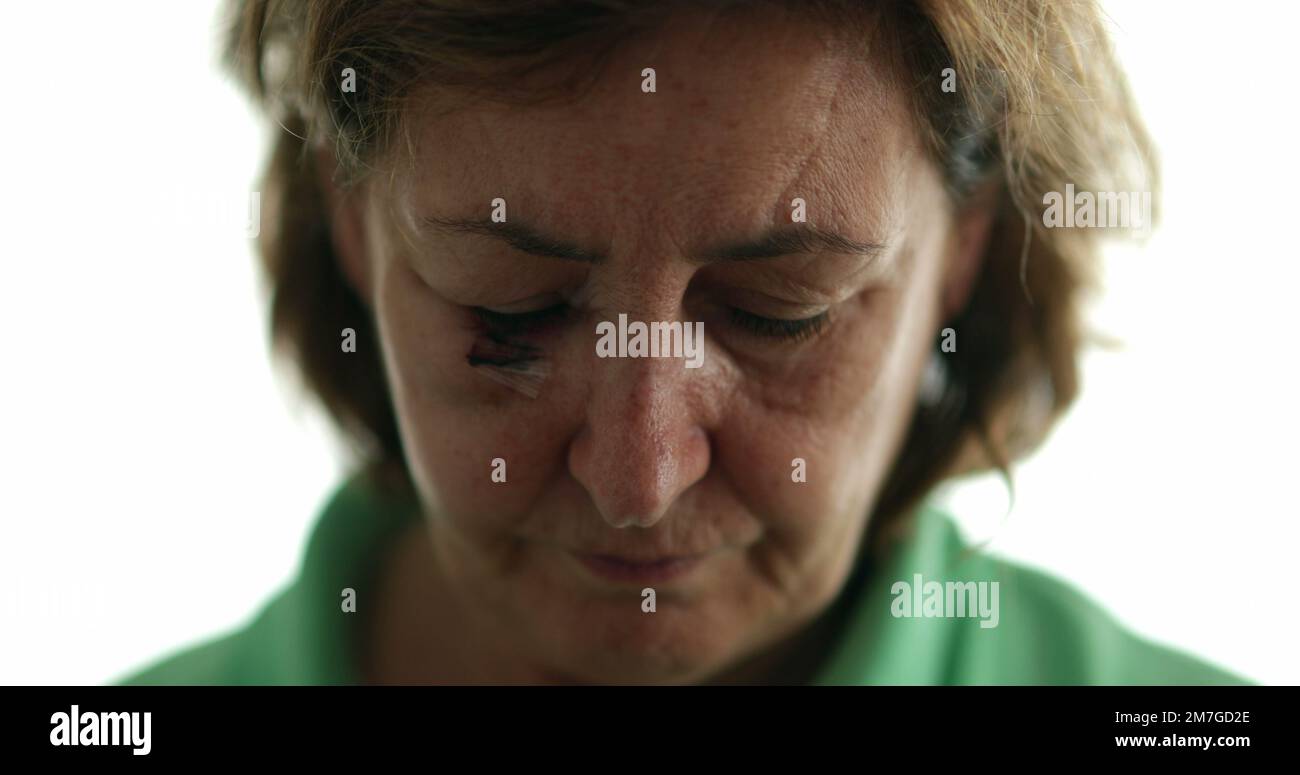 Older woman shaking head with disapproval, portrait of woman with stitches and scar Stock Photo