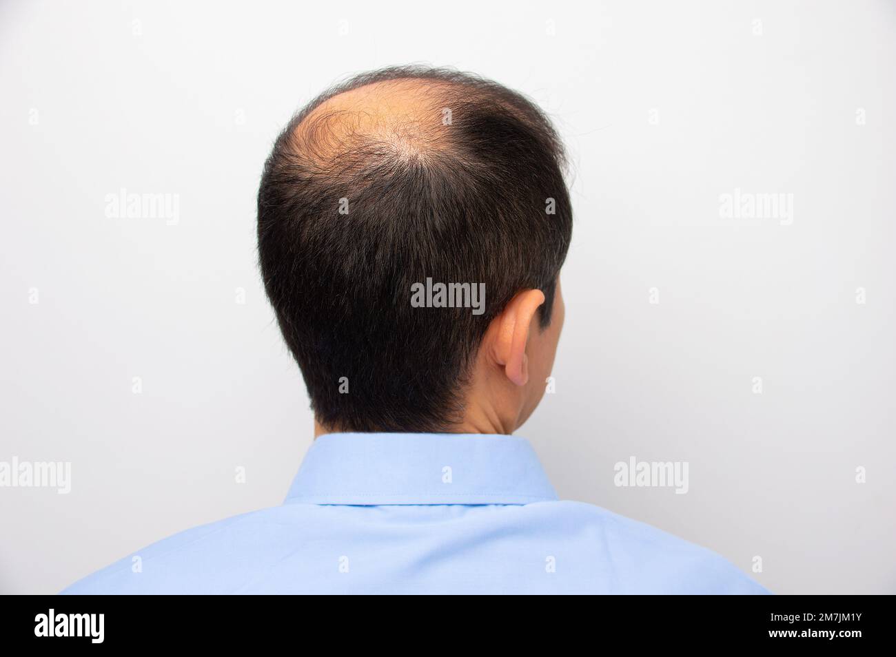 Rear view of a male head with thinning hair or alopecia with white background Stock Photo