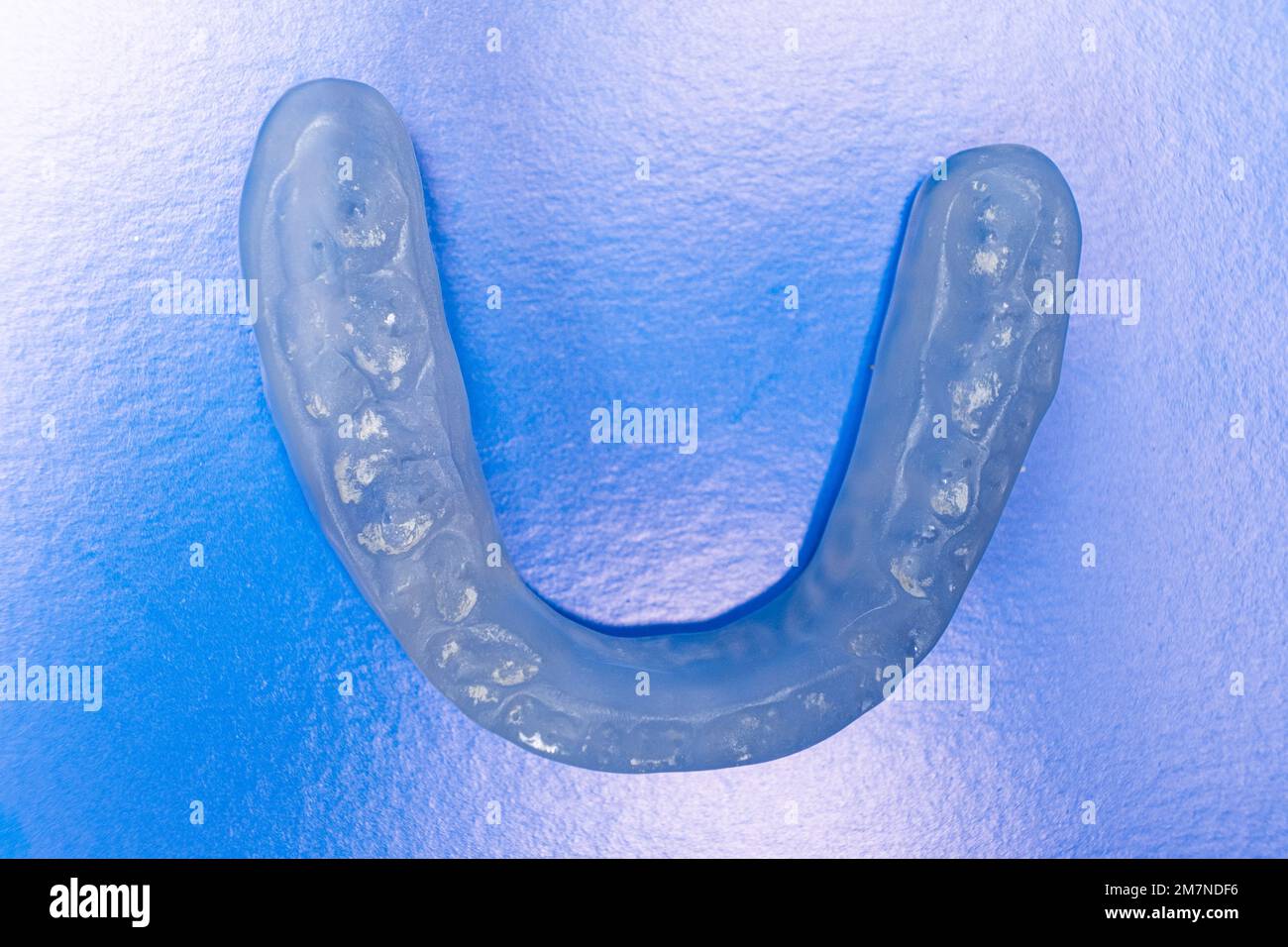 Dental mouthguard, splint for the treatment of dysfunction of the temporomandibular joints, bruxism, malocclusion, to relax the muscles of the jaw. Stock Photo