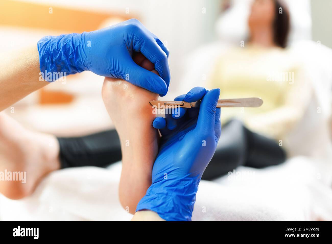 Professional pedicure using dieffenbach scalpel.Patient visiting  podiatrist.Medical pedicure procedure using special instrument with blade  knife holde Stock Photo - Alamy