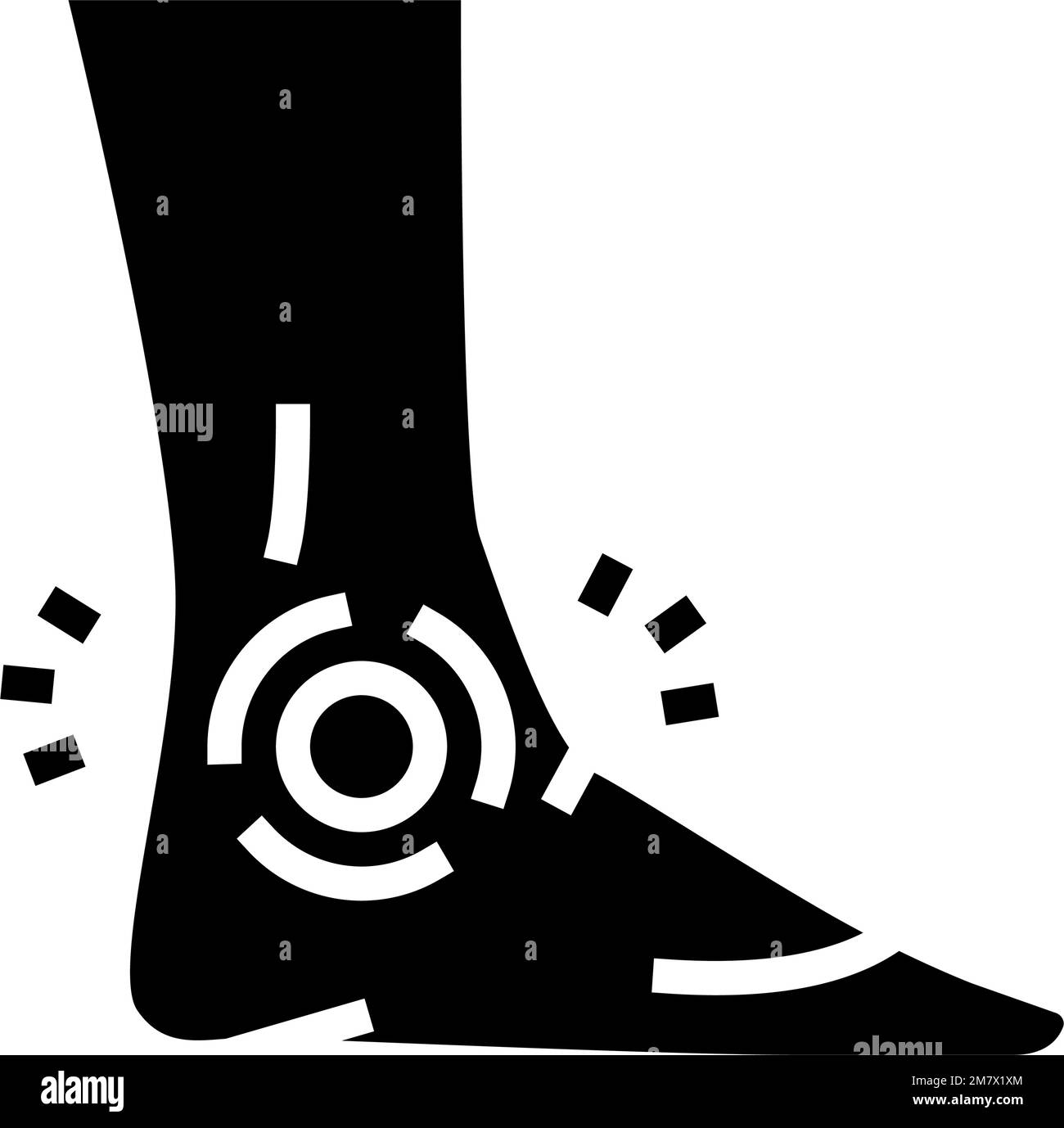 Human ankle pain anatomy injury Black and White Stock Photos & Images ...