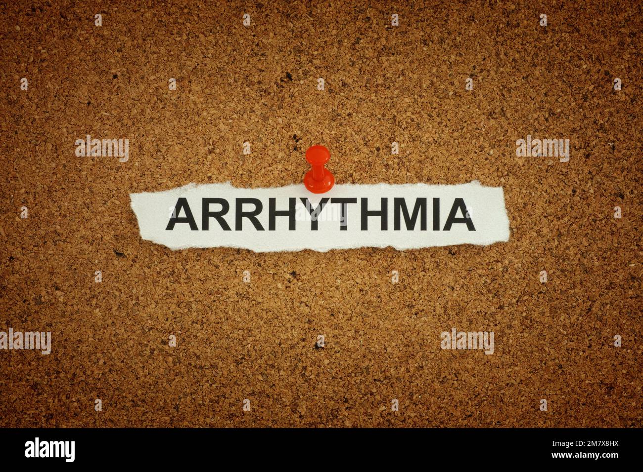 A paper note with the word Arrhythmia on it pinned to a cork board. Close up. Stock Photo