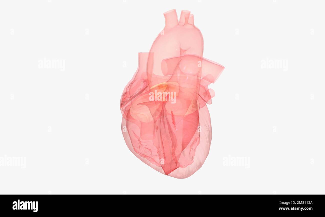 Sometimes the aortic valve can damaged or diseased so it doesn't