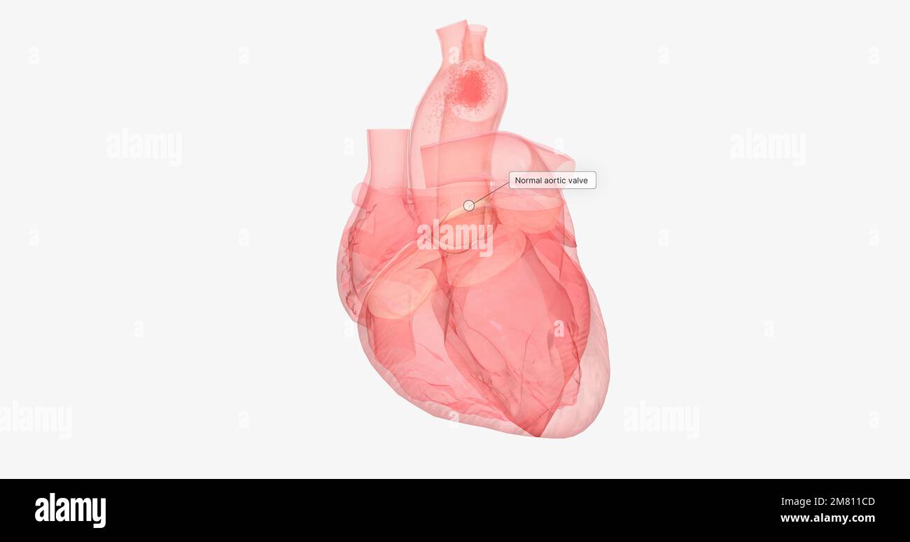 The aortic valve is between the left ventricle of the heart and the