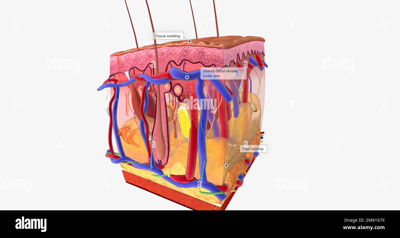 Cutaneous sense hi-res stock photography and images - Alamy