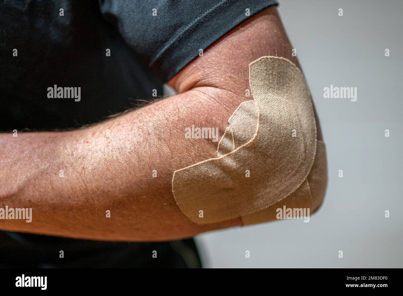 "Tennis elbow" taped with elastic therapeutic at orthopedic ward close