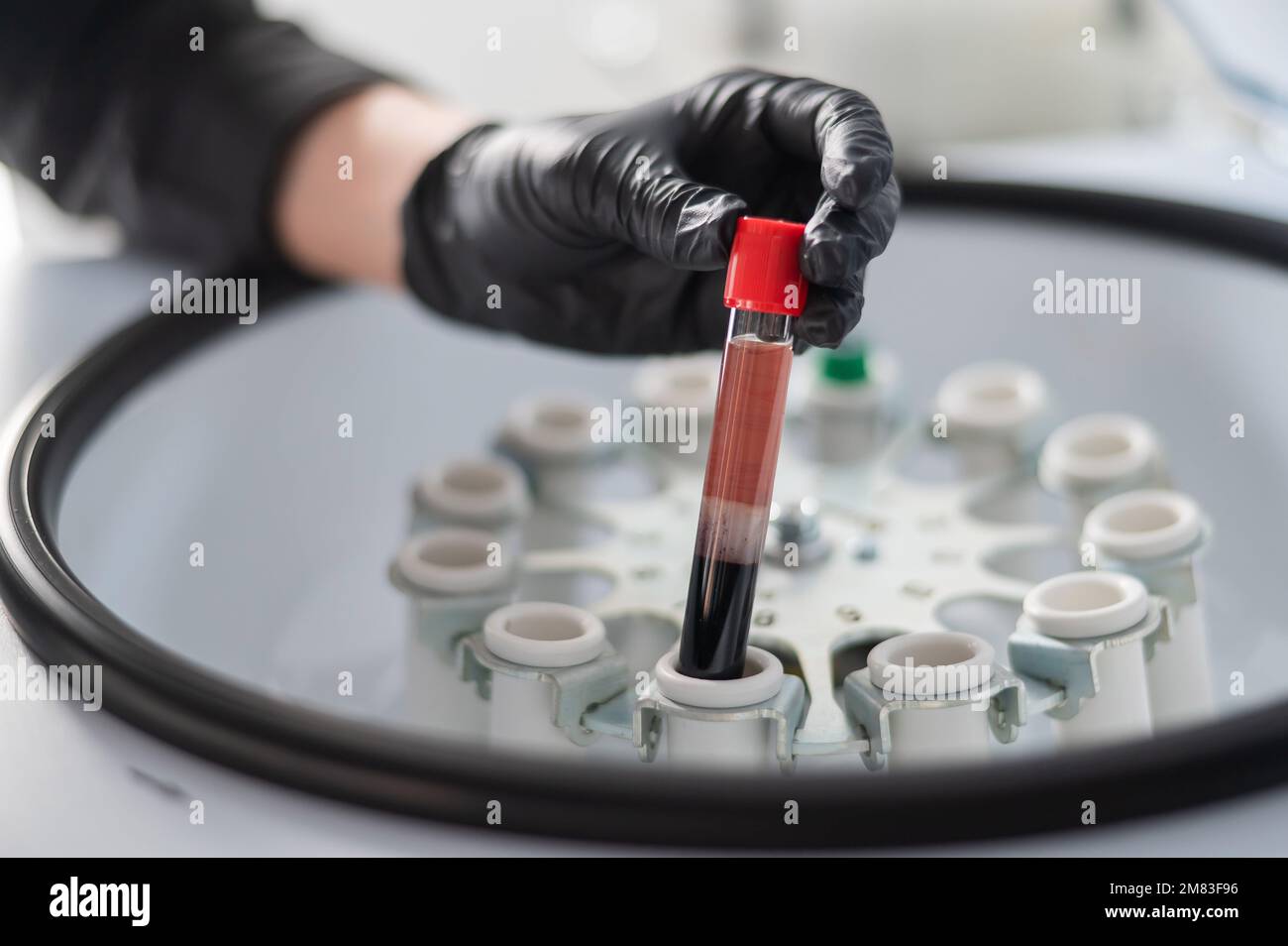 The doctor takes out a test tube with blood plasma from the centrifuge. Plasma lifting procedure for skin rejuvenation. Stock Photo