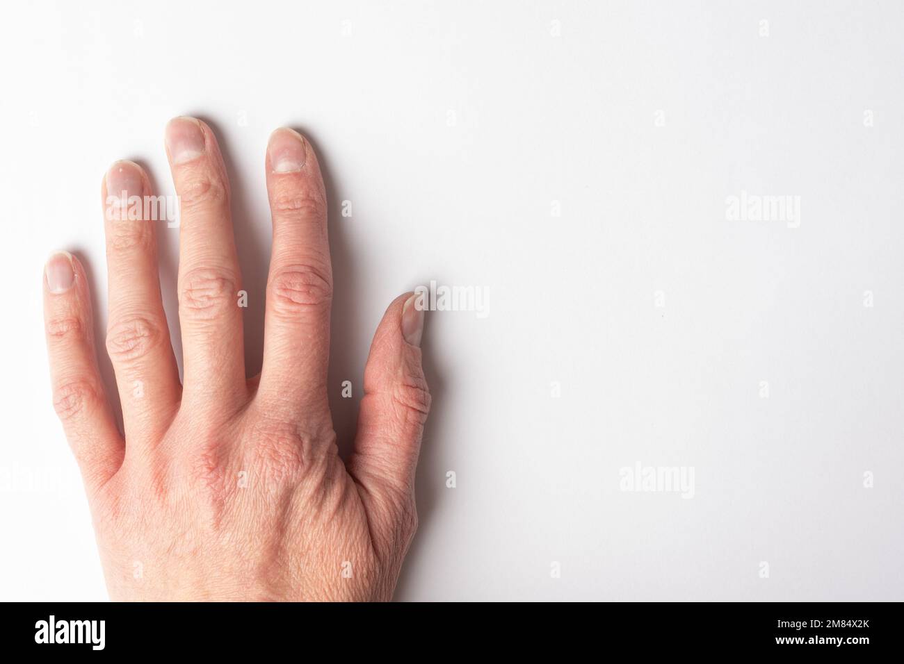 Close-up of a woman's age-old hand with wrinkles with natural nails, overgrown cuticle on a white background, top view, copy space. A hand with age-re Stock Photo