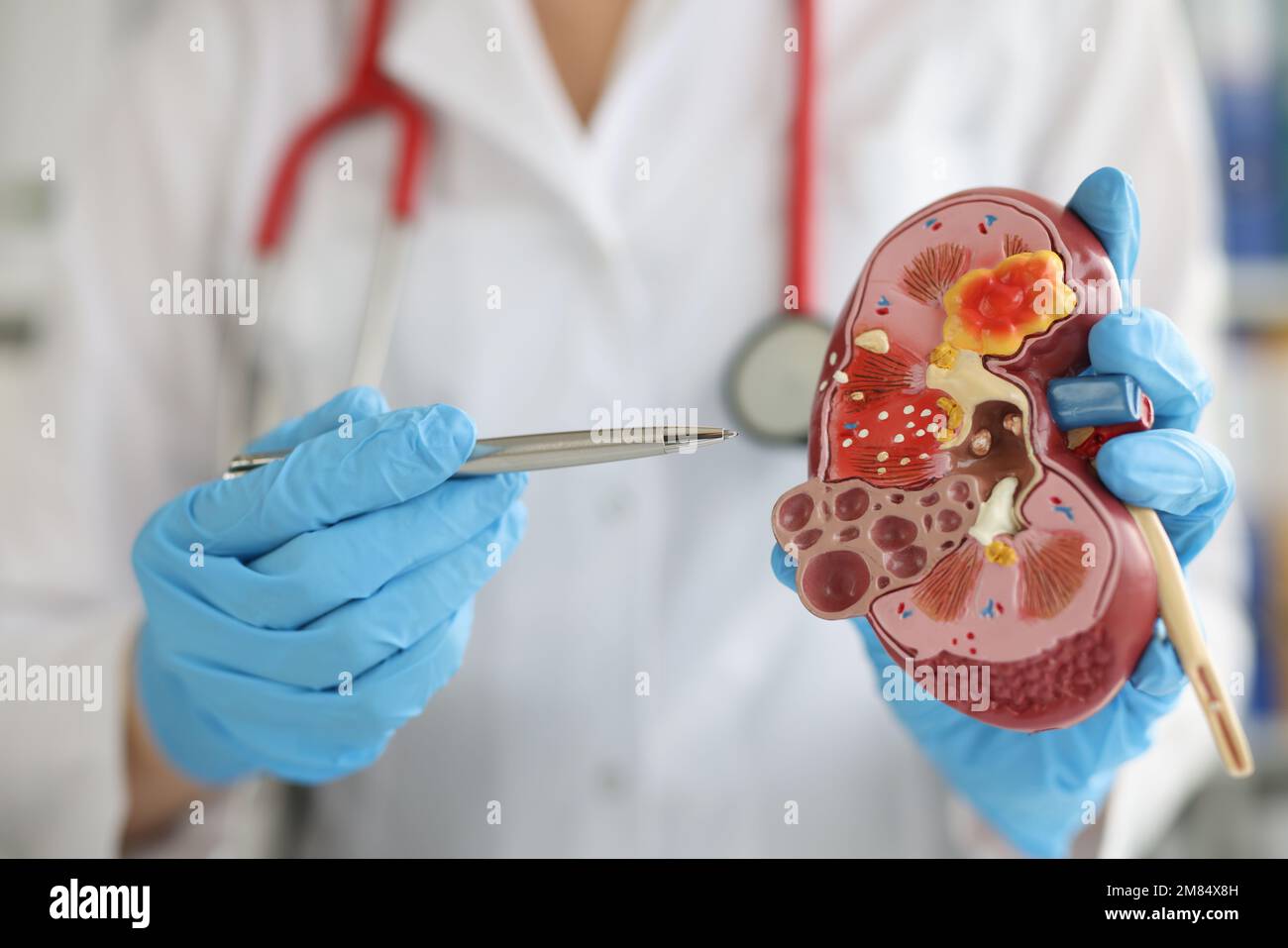 Doctor in hospital is standing holding anatomical model of kidney Stock Photo