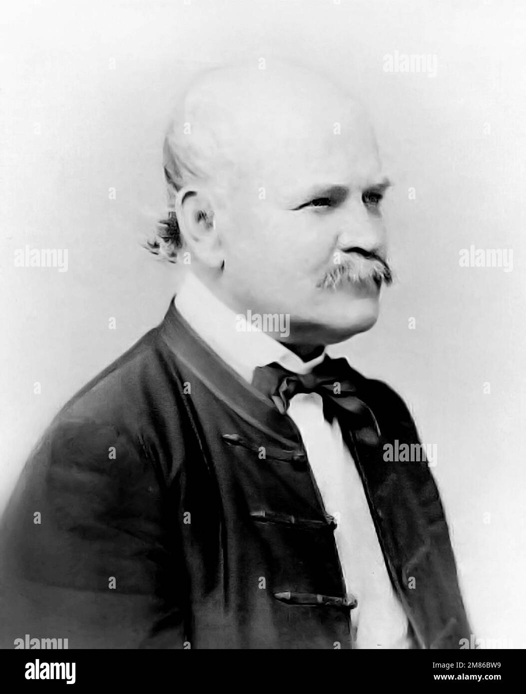 Doctor Ignaz Philipp Semmelweis Hi res Stock Photography And Images Alamy Doctor Ignaz Philipp Semmelweis Hi res Stock Photography And Images Alamy