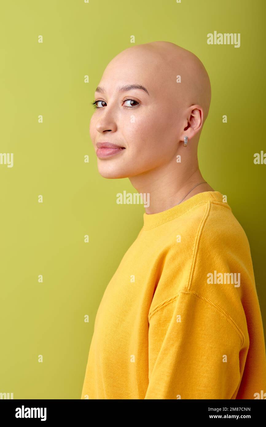 Portrait of hairless bald caucasian female in yellow shirt posing at camera, side view. attractive european lady looking calm and pretty, beautiful, l Stock Photo