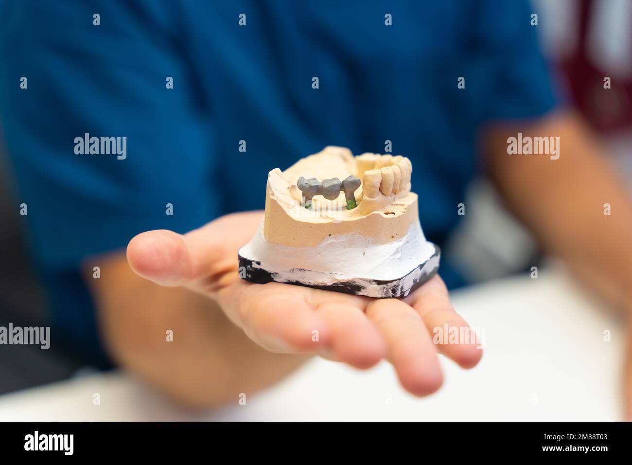 Dental clinic, dentist detail explaining to a client the teeth that must be implanted in a model Stock Photo