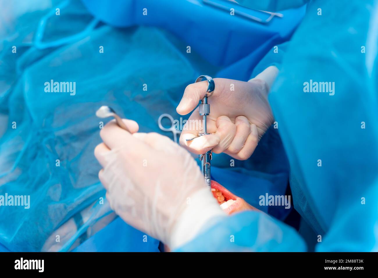 Dental clinic, female dentist doctor applying anesthesia injection ...