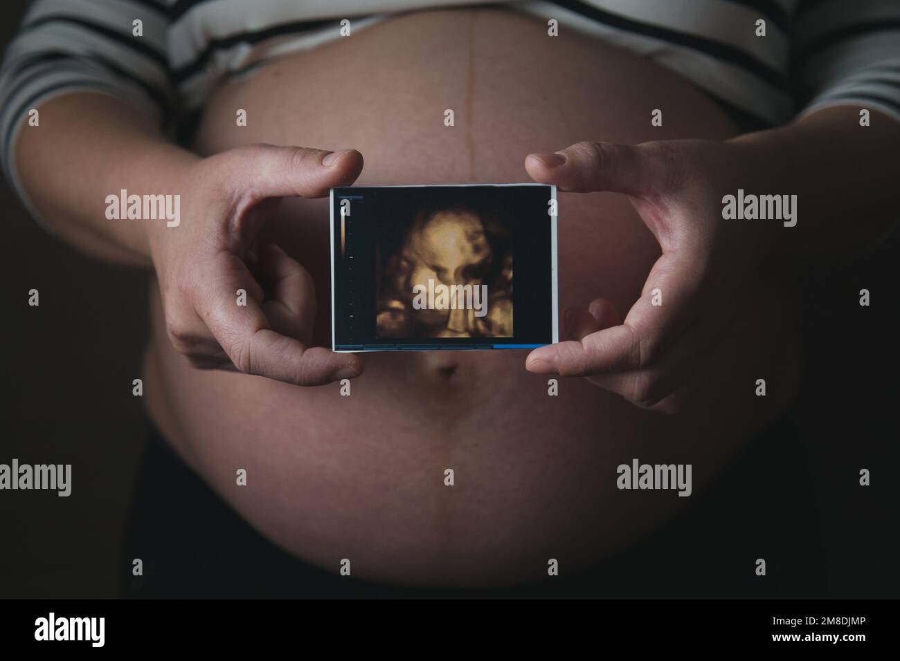 Ultrasonography hi-res stock photography and images - Alamy