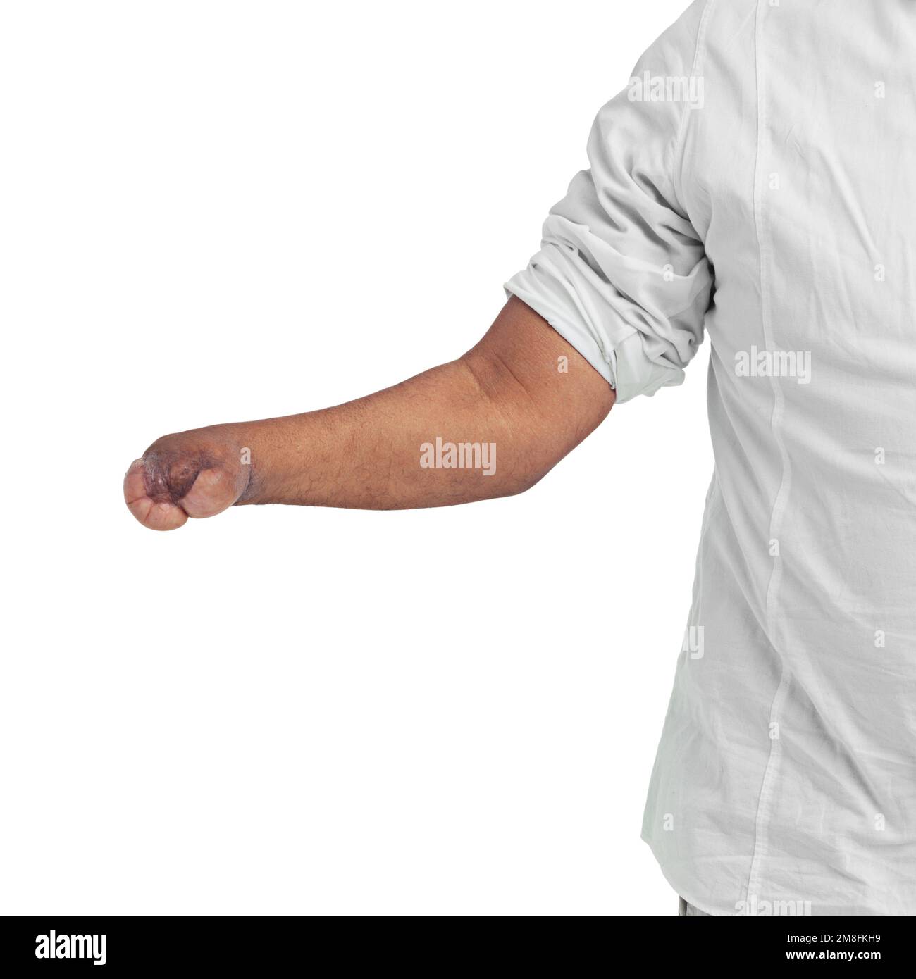 Hand, disability and mockup with a man in studio isolated on a white ...