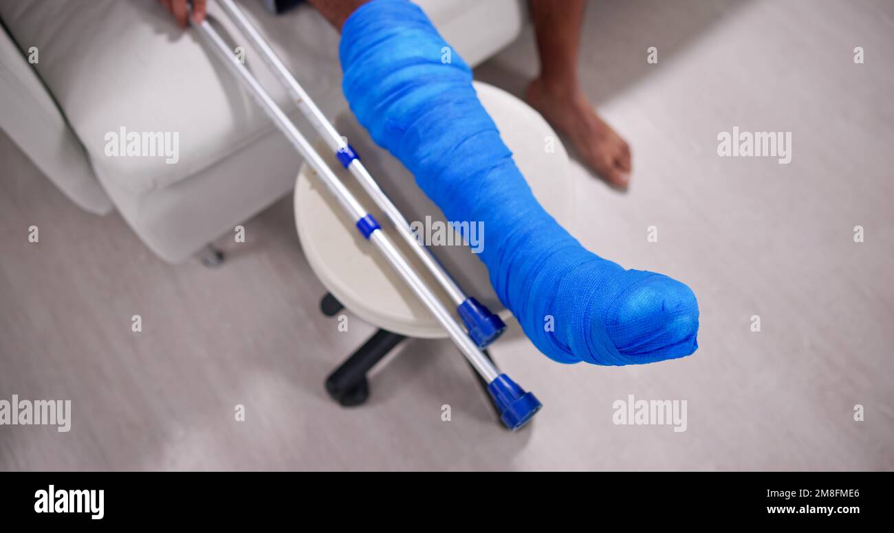 Young Man With Broken Leg Sitting On Sofa Stock Photo