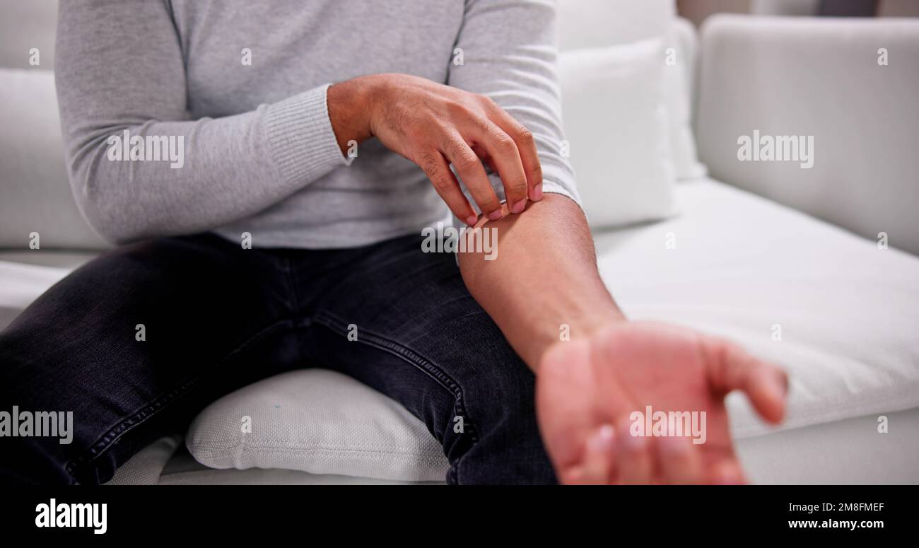 Man Scratching Itching Body Skin With Allergy Stock Photo