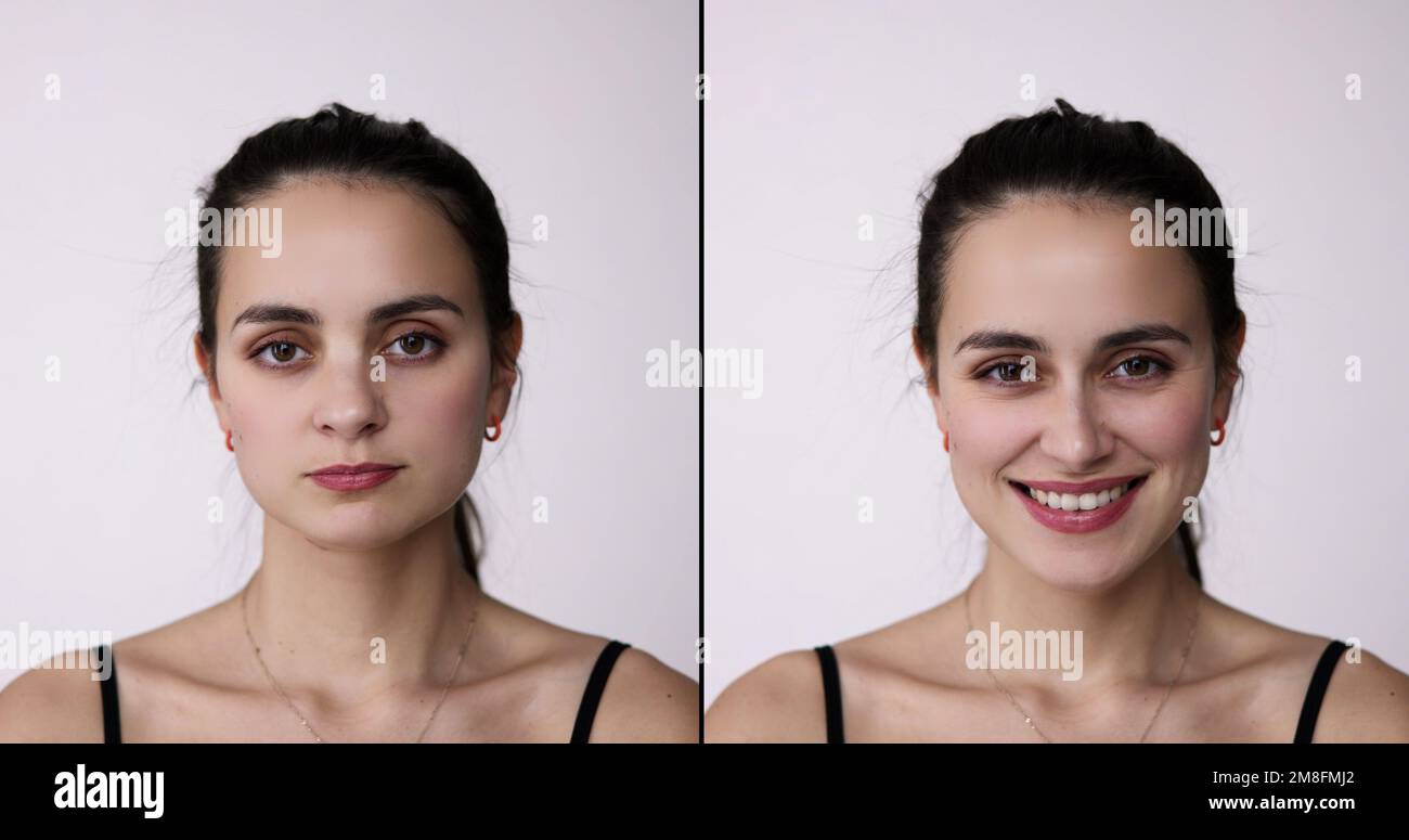 Before After Young Woman Aesthetic Facelift. Rhinoplasty Nose And Mid Face Surgery Stock Photo