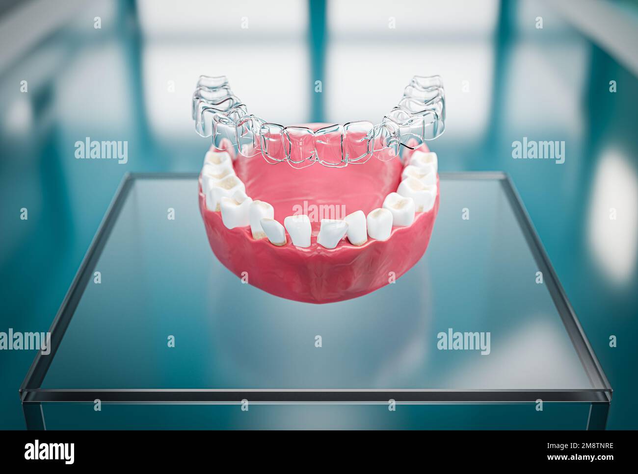 Transparent aligner orthodontic device above teeth cast. 3d