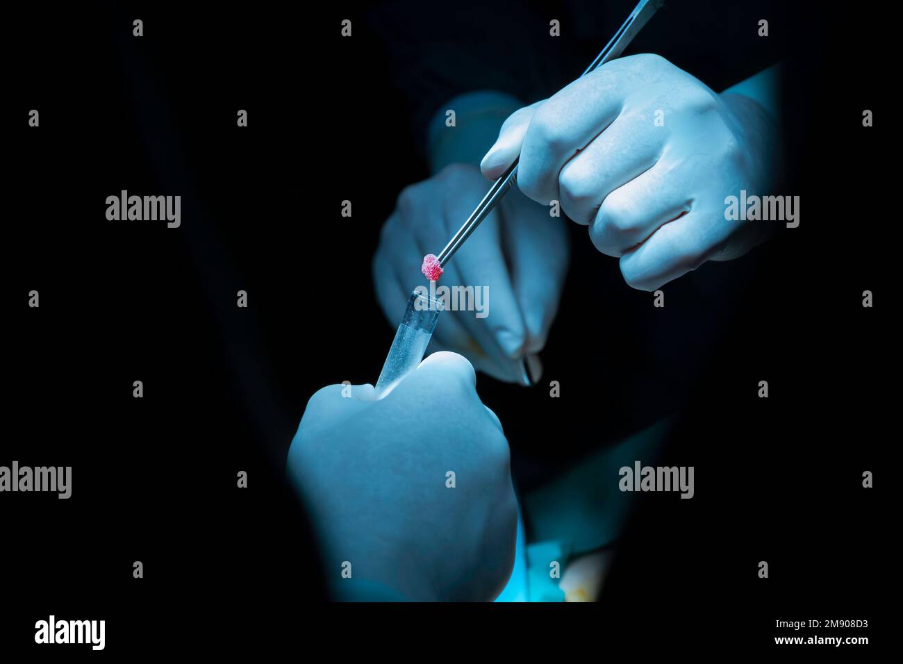 concentrated professional surgical doctor team operating surgery a