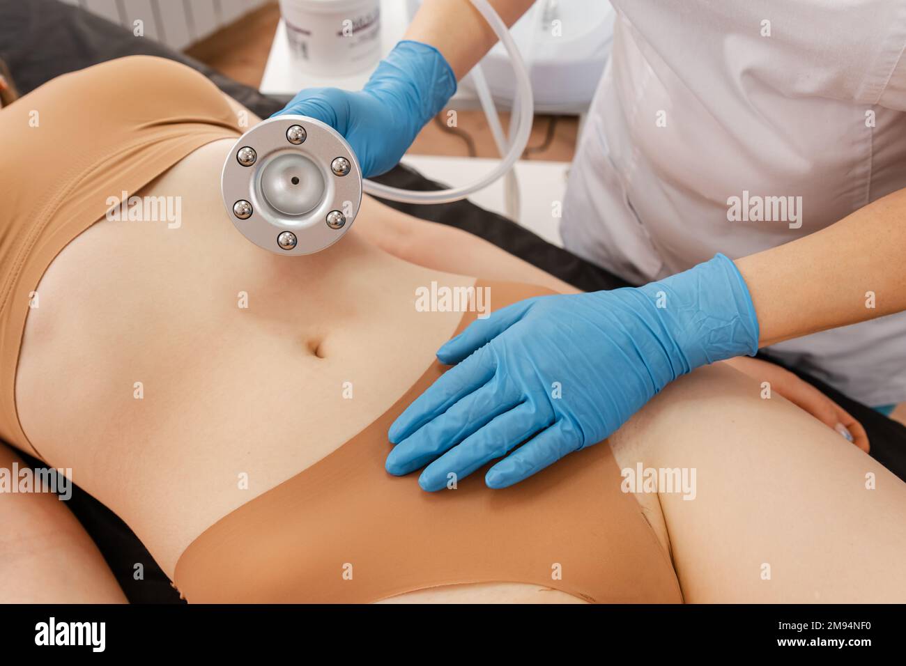 Destruction of cellulite in the abdominal area by ultrasound device. Stock Photo