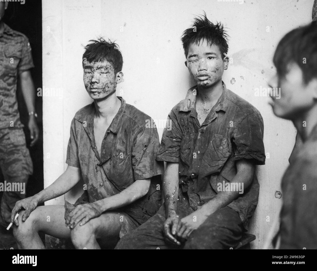 Quang Tri: Two young North Vietnamese soldiers, who have been captured, their faces splattered with dried blood and dirt, sit against a white wall, holding cigarettes Stock Photo