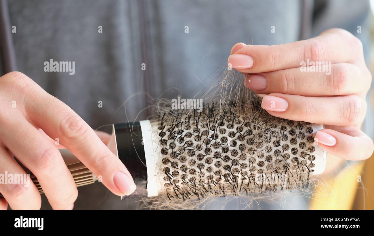 Women's hands hold comb with a lot of fallen hair. Stock Photo