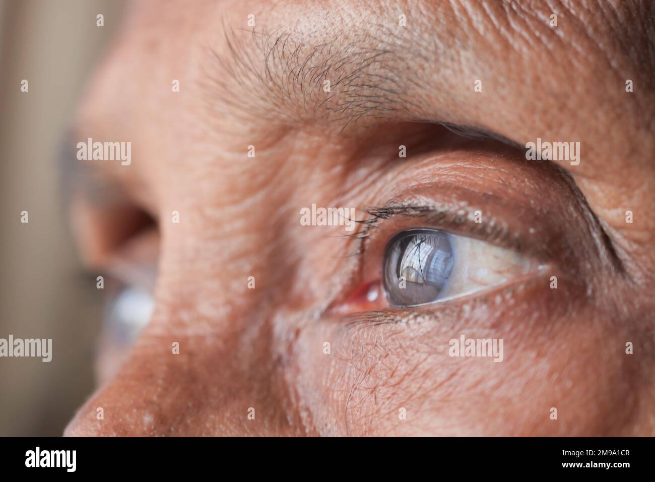 detail shot of asian senior women eye  Stock Photo