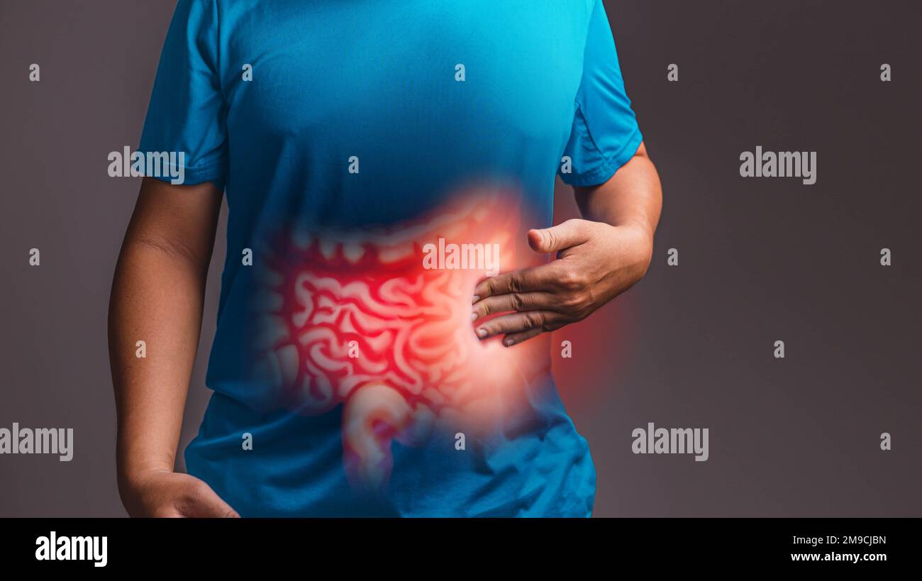 Irritable Bowel Syndrome (IBS)., xray concept Stock Photo Alamy