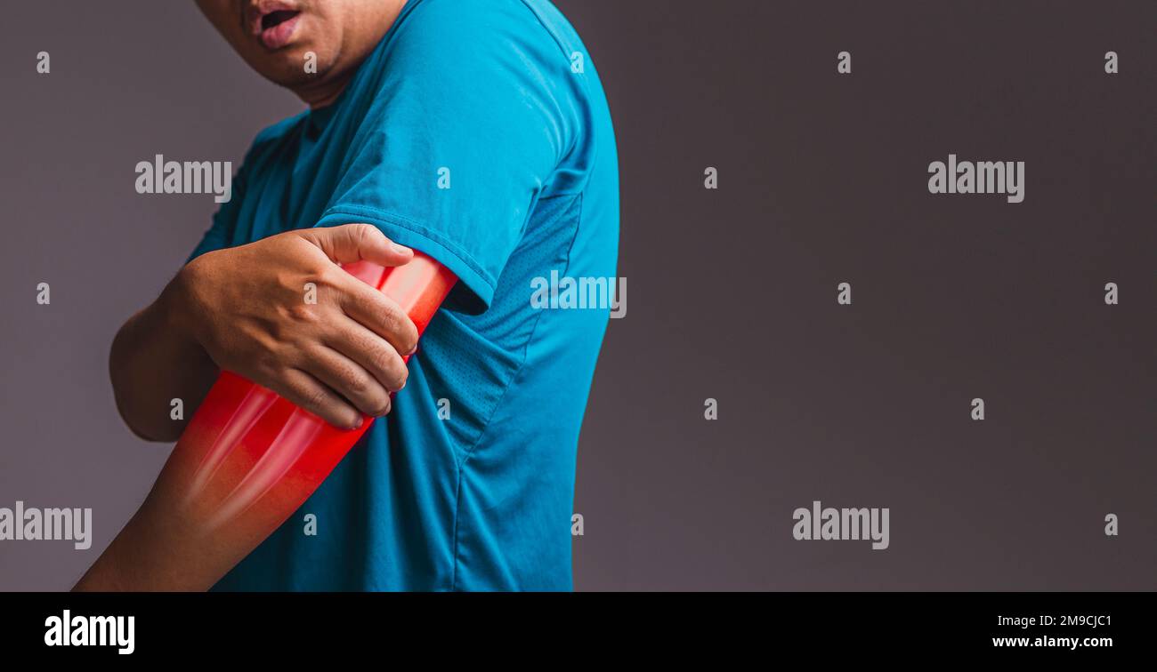 Elbow x ray hires stock photography and images Alamy