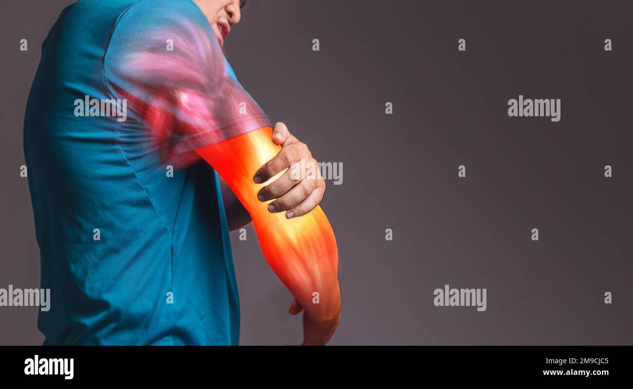 A man holding hands., tennis elbow., xray concept Stock Photo Alamy