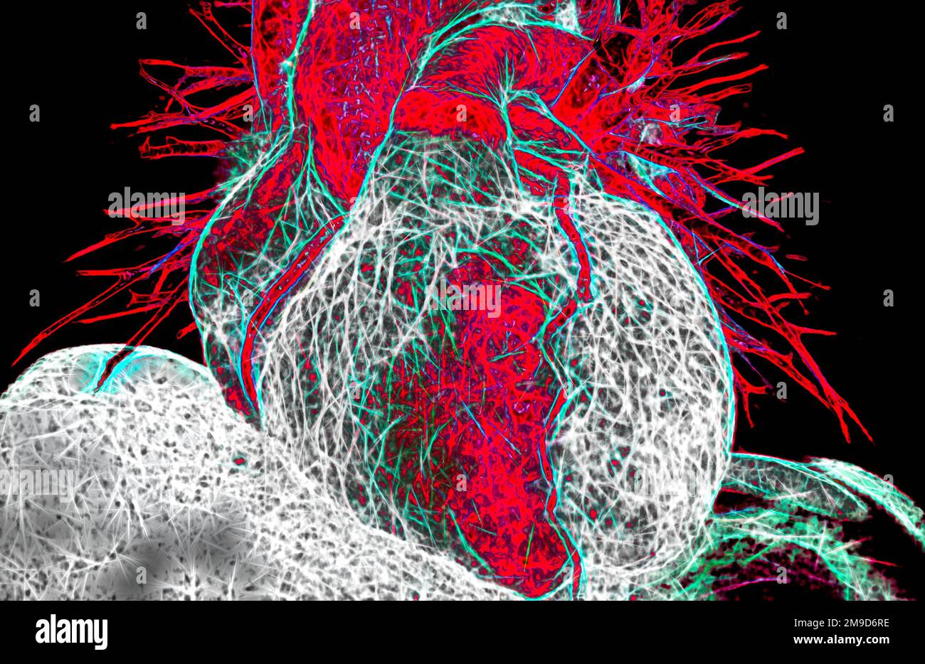 Healthy heart, CT scan Stock Photo - Alamy