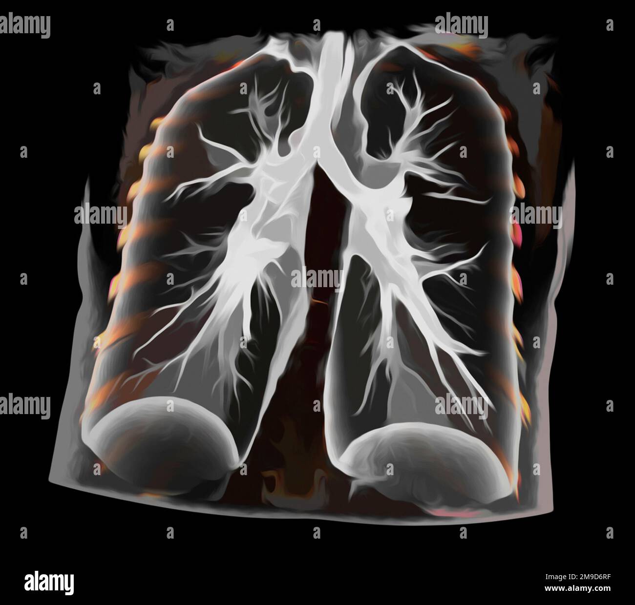 Healthy lungs, CT scan Stock Photo Alamy