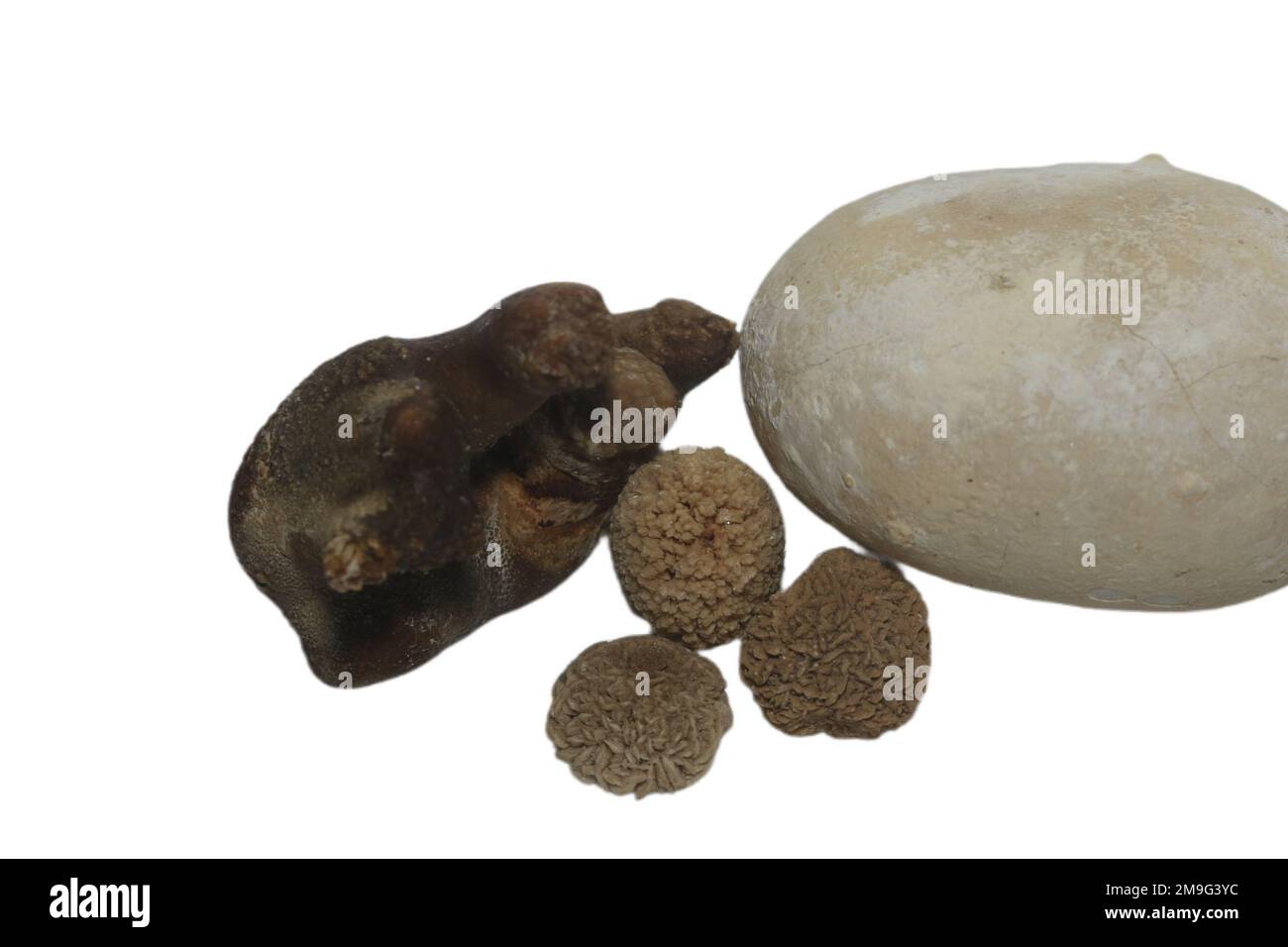 The different brown renal calculi or kidney stones isolated on white