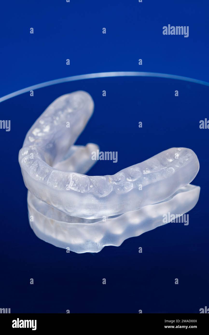 Dental mouthguard, splint for the treatment of dysfunction of the temporomandibular joints, bruxism, malocclusion, to relax the muscles of the jaw. Stock Photo