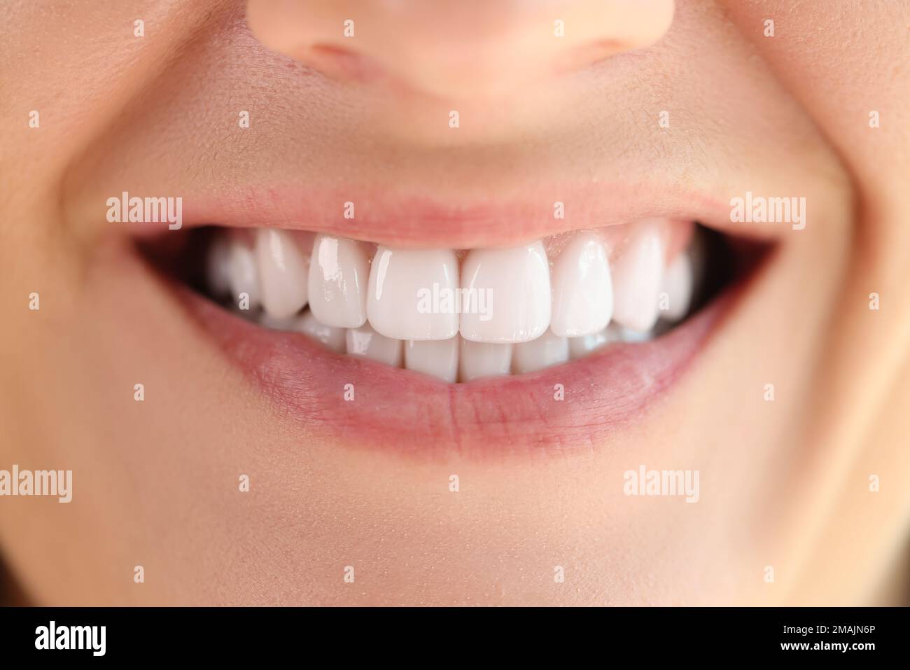 Close-up of healthy smooth white teeth smile. Stock Photo