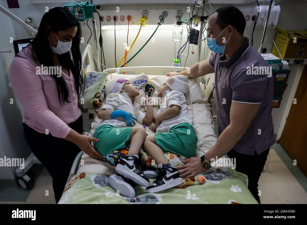 Arthur, center left, and Bernardo de Sousa Lima, twins conjoined at the