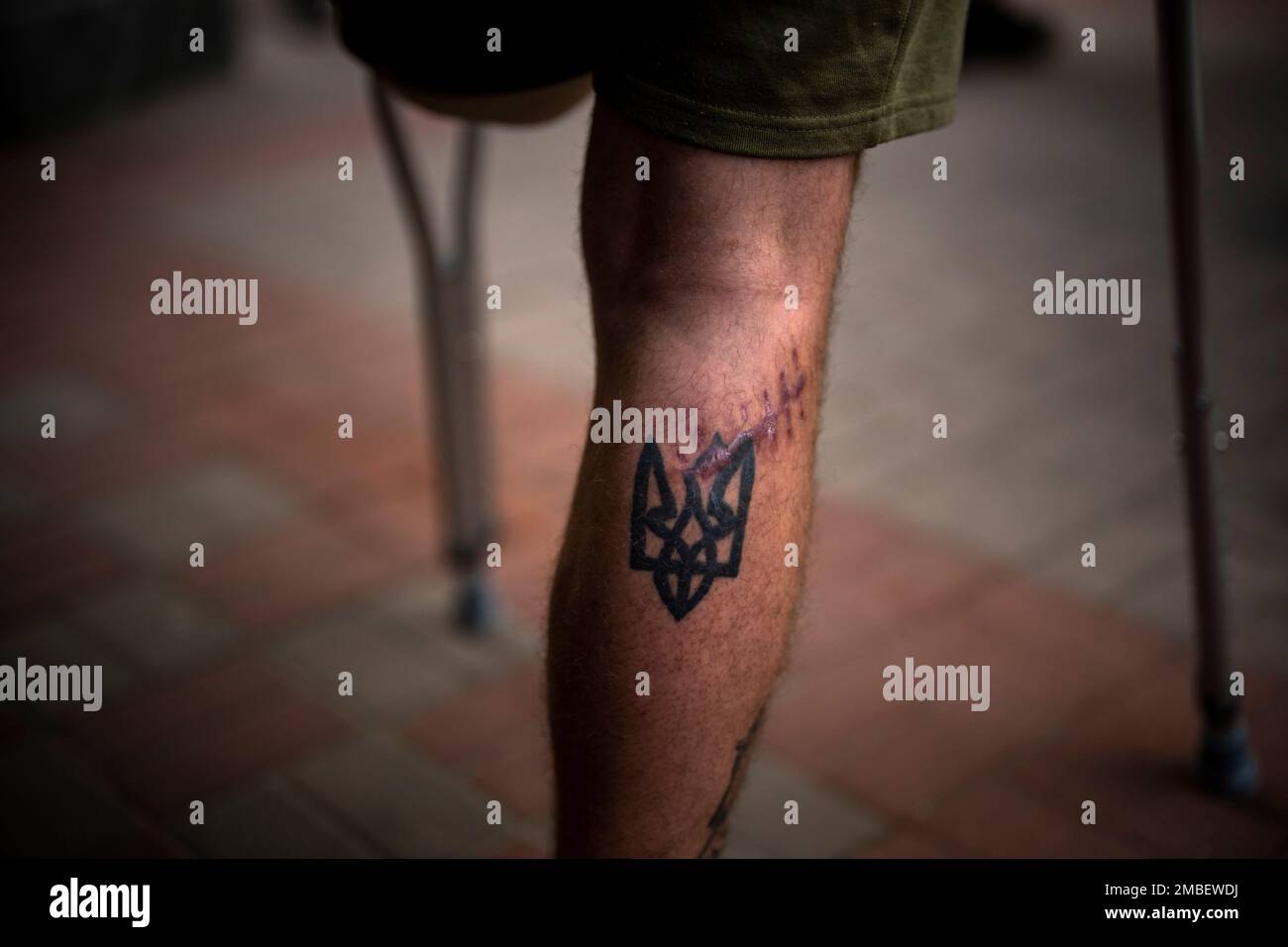 Soldier Vitalii Skidan, 26, of the Azoz Regiment, shows a tattoo of the Ukrainian  coat of arms crossed by a wound scar on his leg, while walking with  crutches to a rehabilitation