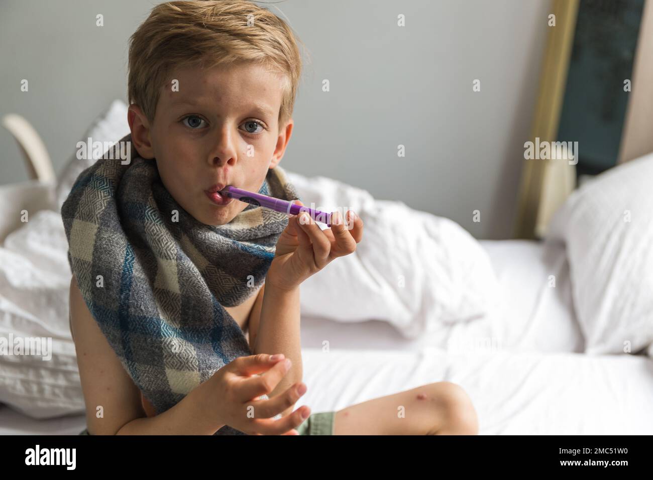 Young toddler with chickenpox. Sick child with chickenpox. Varicella